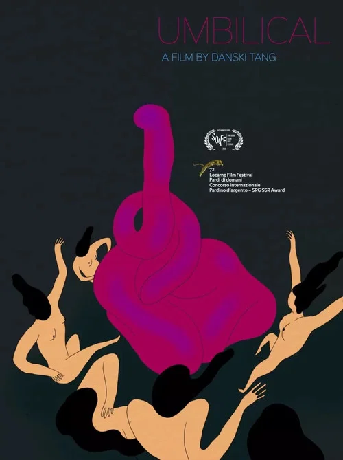 Umbilical
