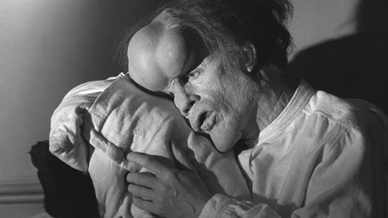 The Elephant Man screenshot 1