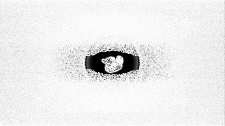 Severe Severance screenshot 1