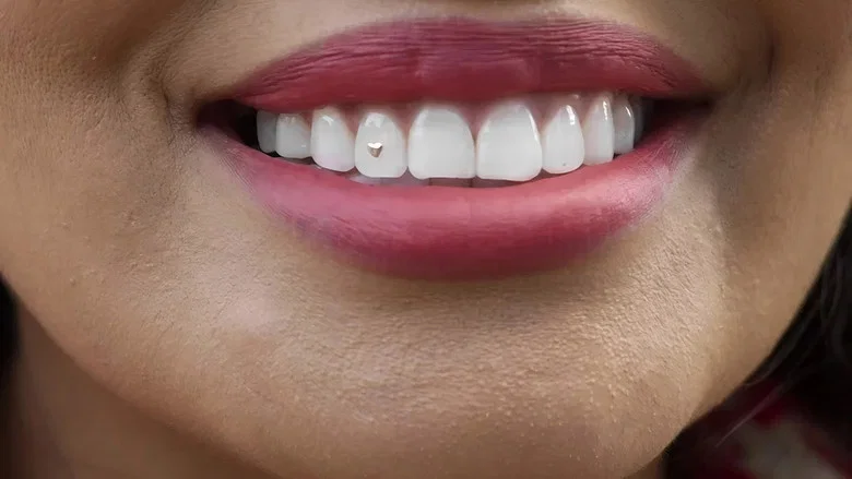 Open Wide screenshot 1