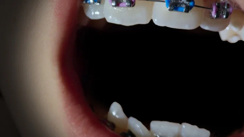 Open Wide screenshot 4
