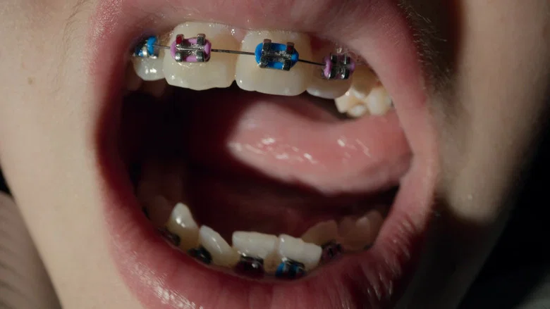 Open Wide screenshot 5